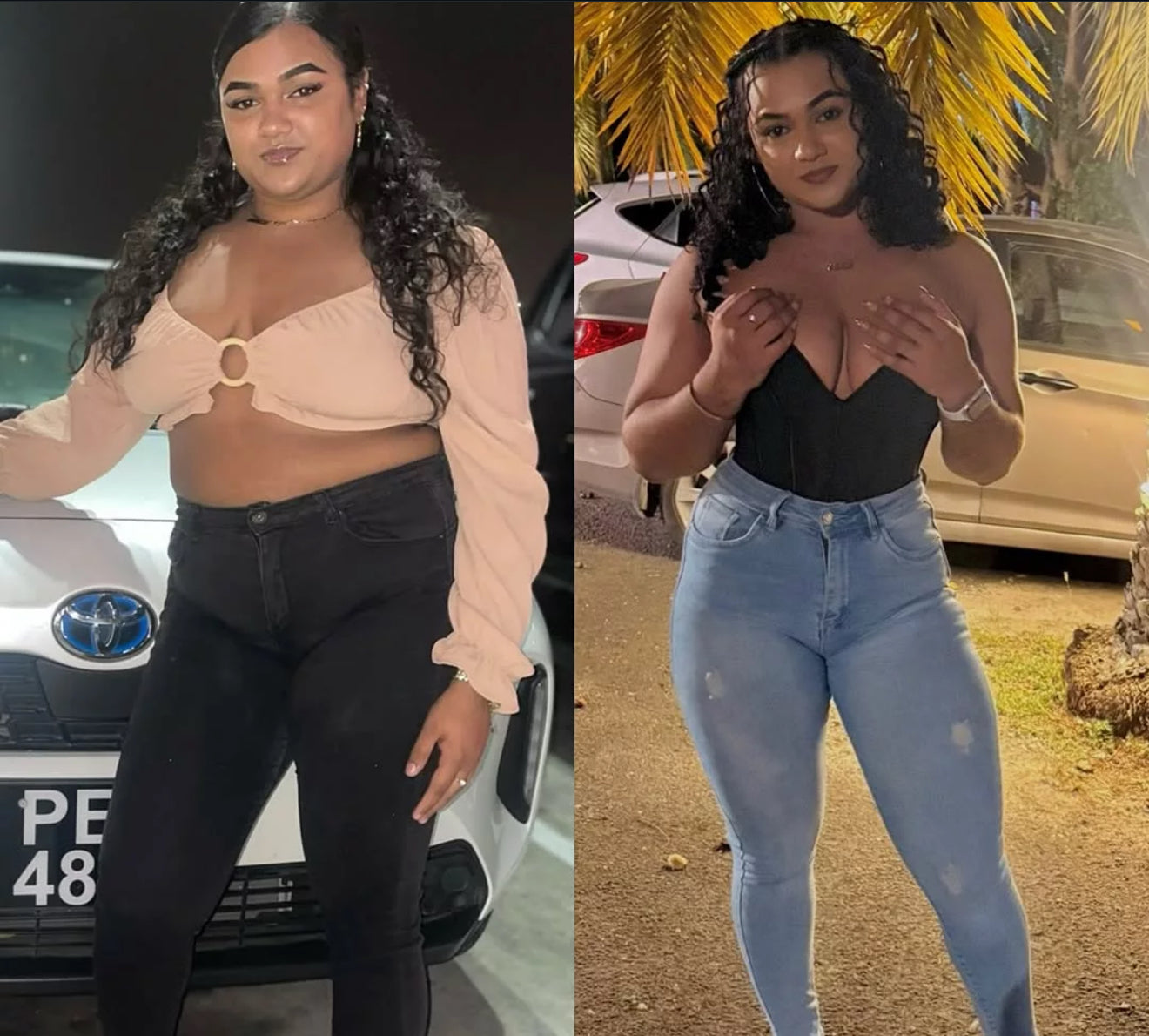 Snap Back Postpartum Bundle