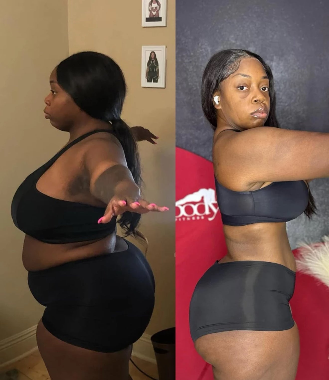 Snap Back Postpartum Bundle