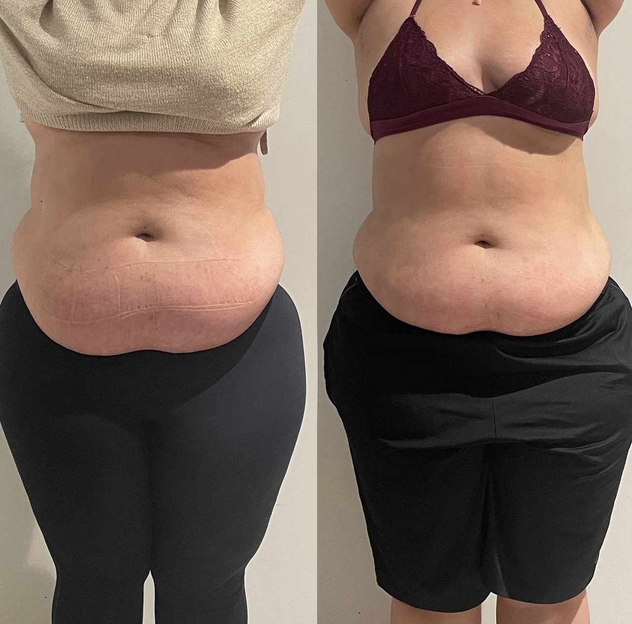 The Snatch Trio Bundle